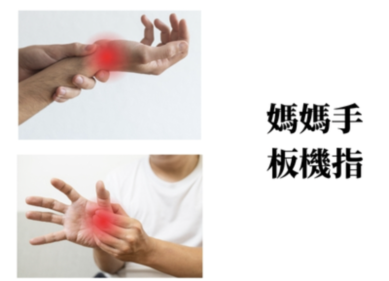 媽媽手、板機指