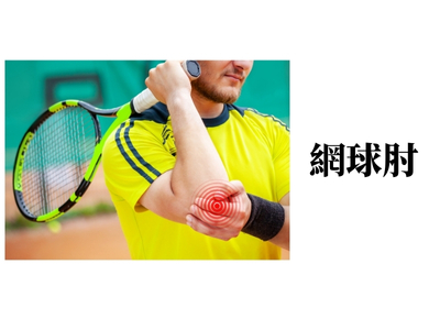 網球肘