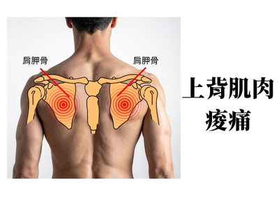 上背肌肉痠痛