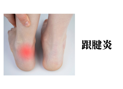跟腱炎