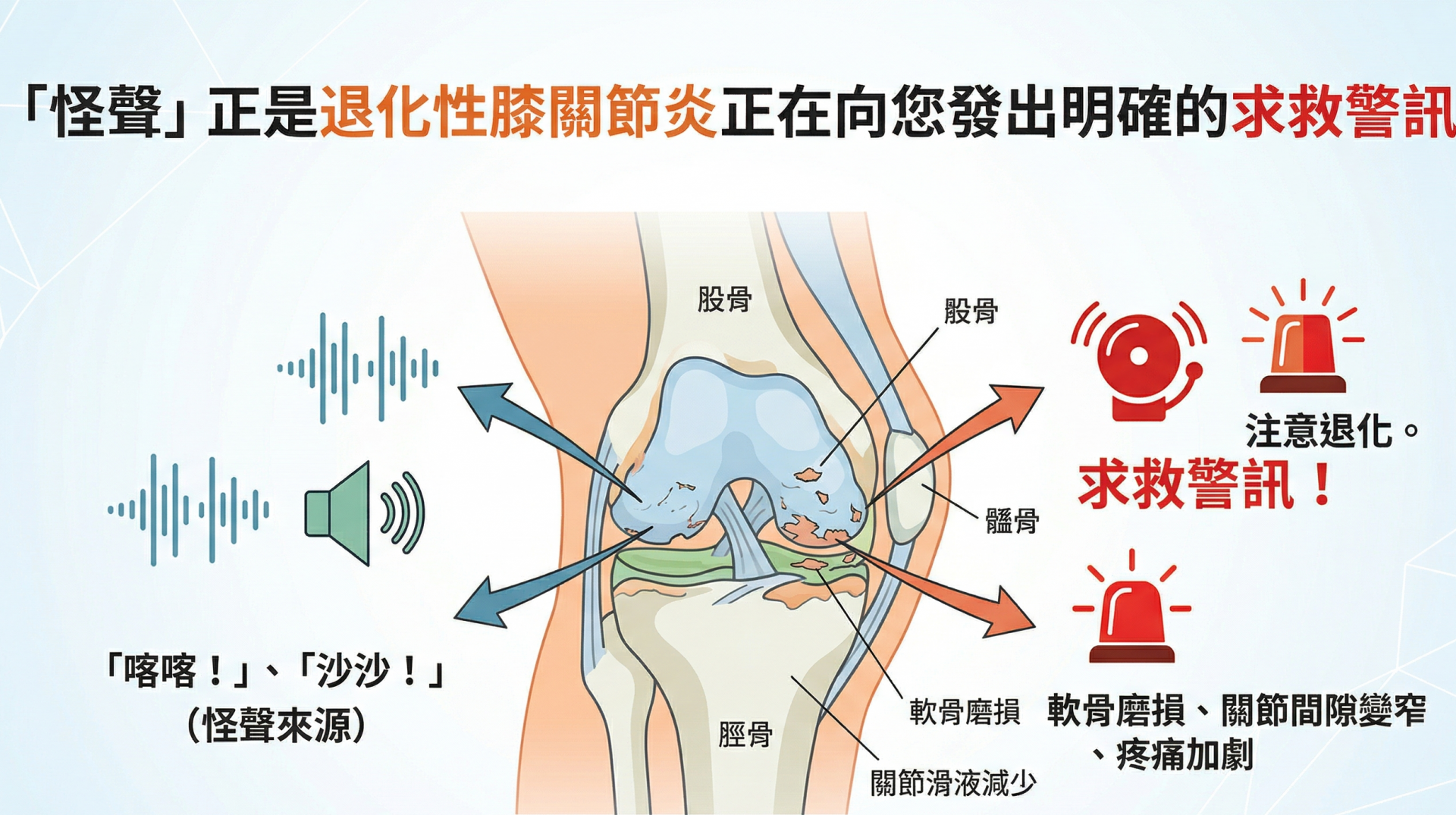 有怪聲？6招減緩退化性膝關節炎，不動刀的關節保養新觀念