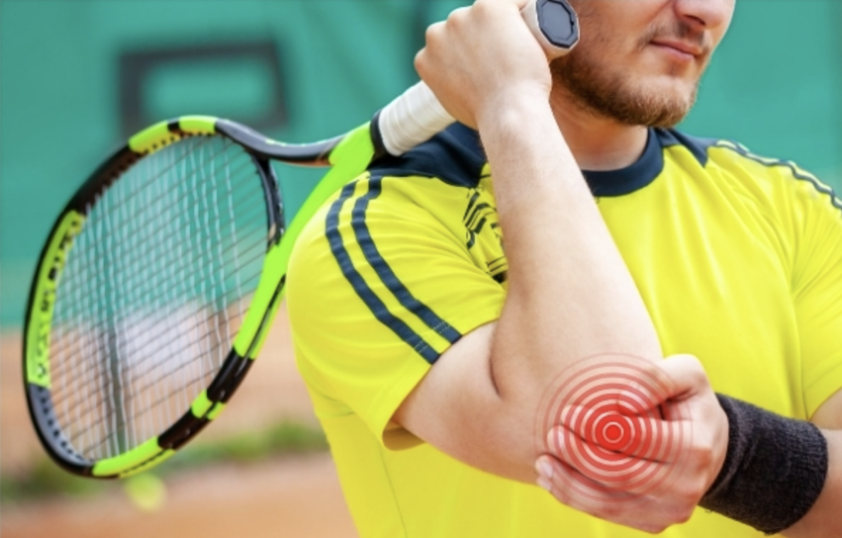 網球肘
