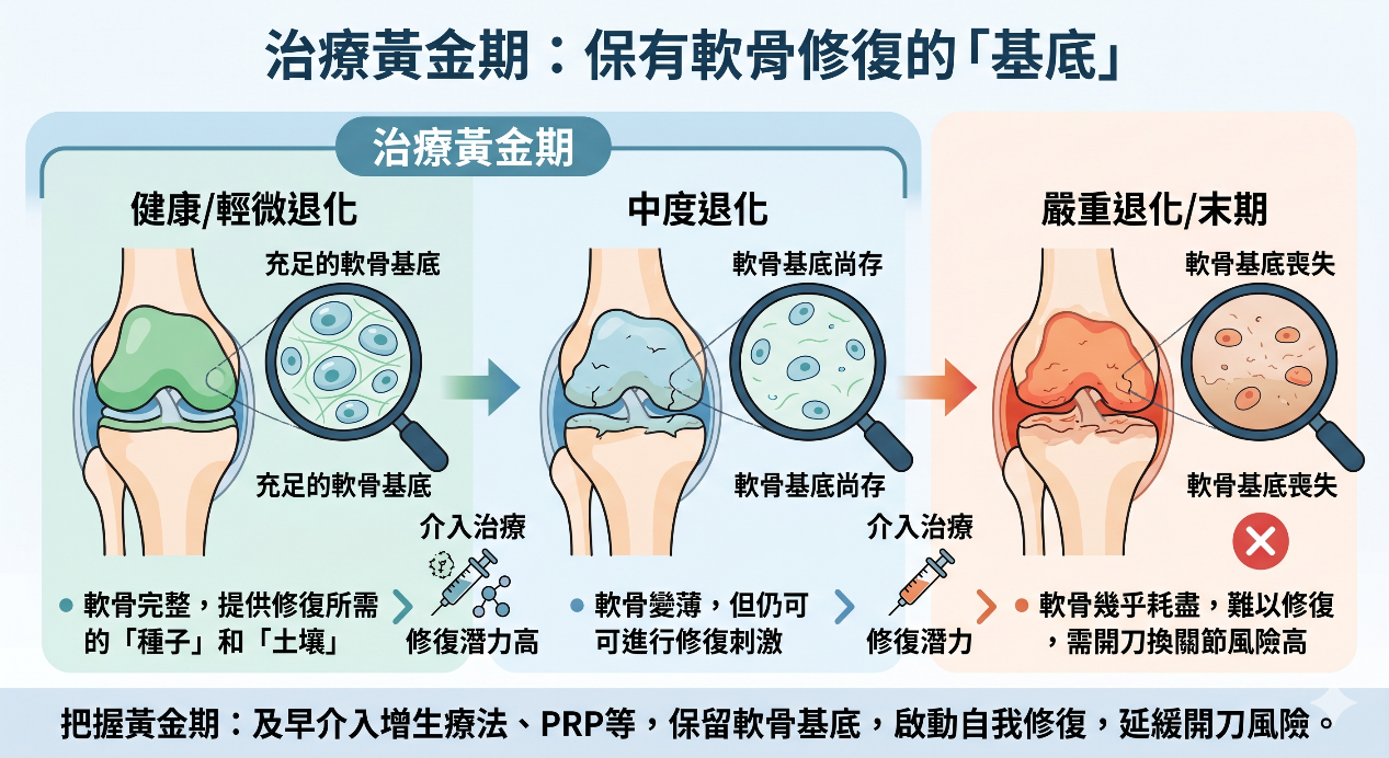 把握髖關節退化治療黃金期：不動刀的增生療法，精準修復髖關節疼痛