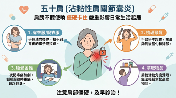 五十肩症狀、發生原因一覽：醫師破除常見迷思，不動恐更嚴重！