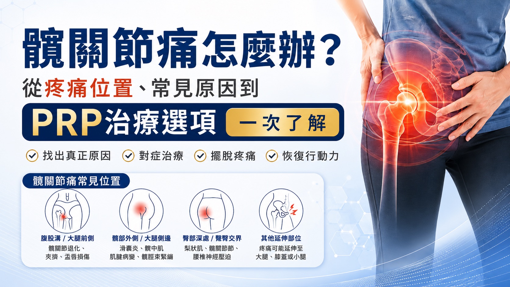 髖關節痛怎麼辦？從疼痛位置、常見原因到PRP治療選項一次了解