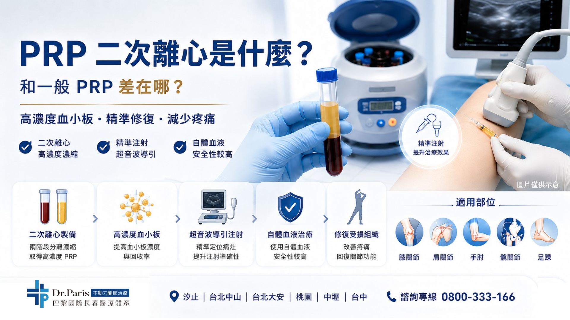 PRP不都是抽自己的血打回去？解析二次離心高濃度PRP優勢與應用