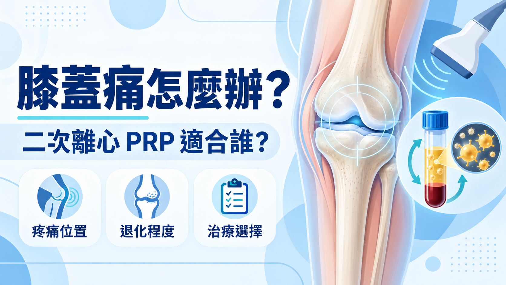 膝蓋痛怎麼辦?二次離心PRP適合誰?從疼痛位置、退化程度到治療選擇一次看