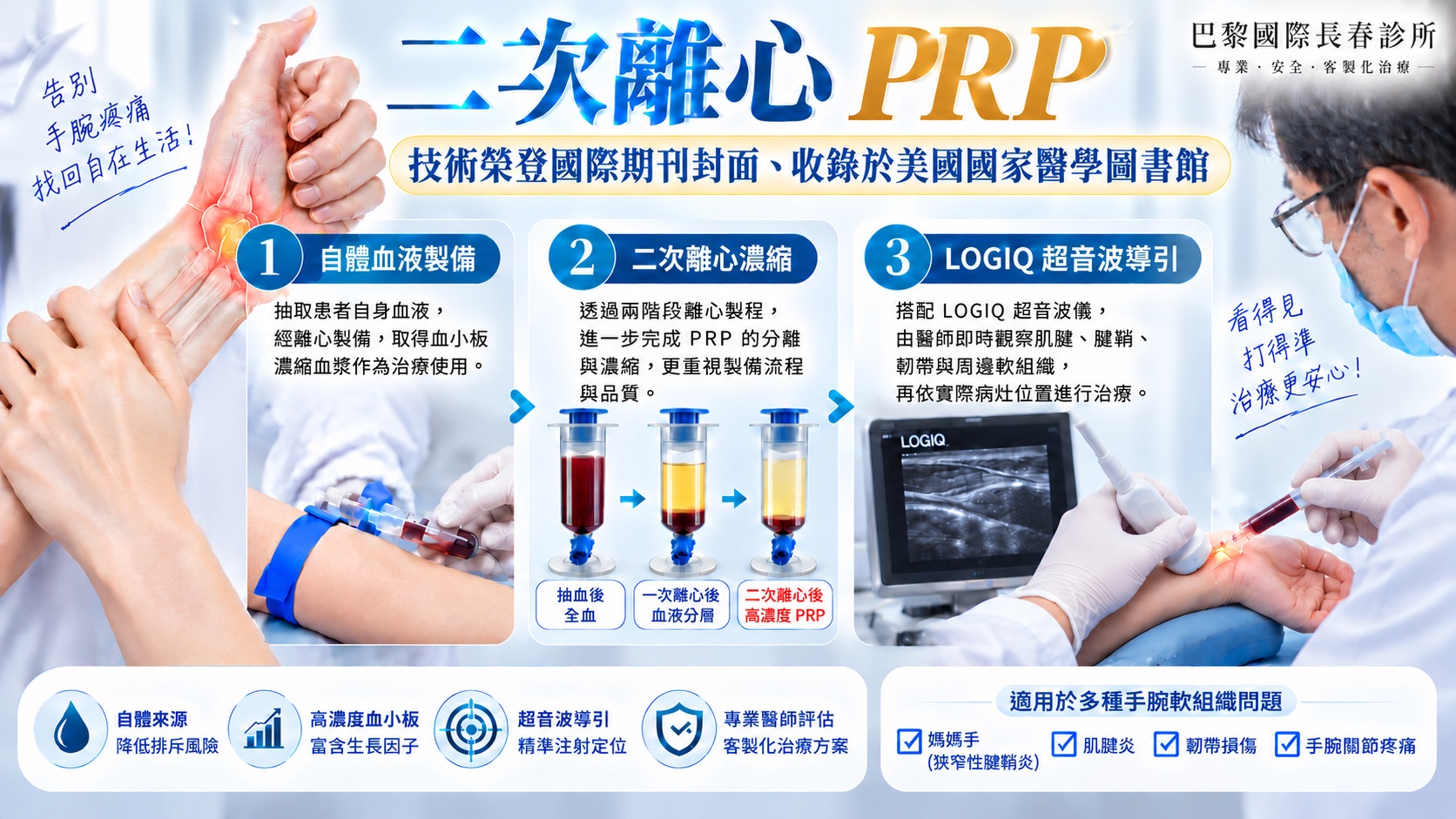巴黎國際長春診所二次離心高濃度PRP治療媽媽手與手腕疼痛示意圖，說明自體血液抽取後使用德國專利KIT管，經一次離心血液分層及二次離心濃縮取得高濃度PRP，再搭配LOGIQ超音波導引，由醫師即時觀察手腕肌腱、腱鞘、韌帶與周邊軟組織病灶位置進行精準注射。適用於媽媽手（狹窄性腱鞘炎）、肌腱炎、韌帶損傷及手腕關節疼痛等問題；巴黎國際長春診所二次離心PRP技術曾榮登國際期刊封面，並收錄於美國國家醫學圖書館。