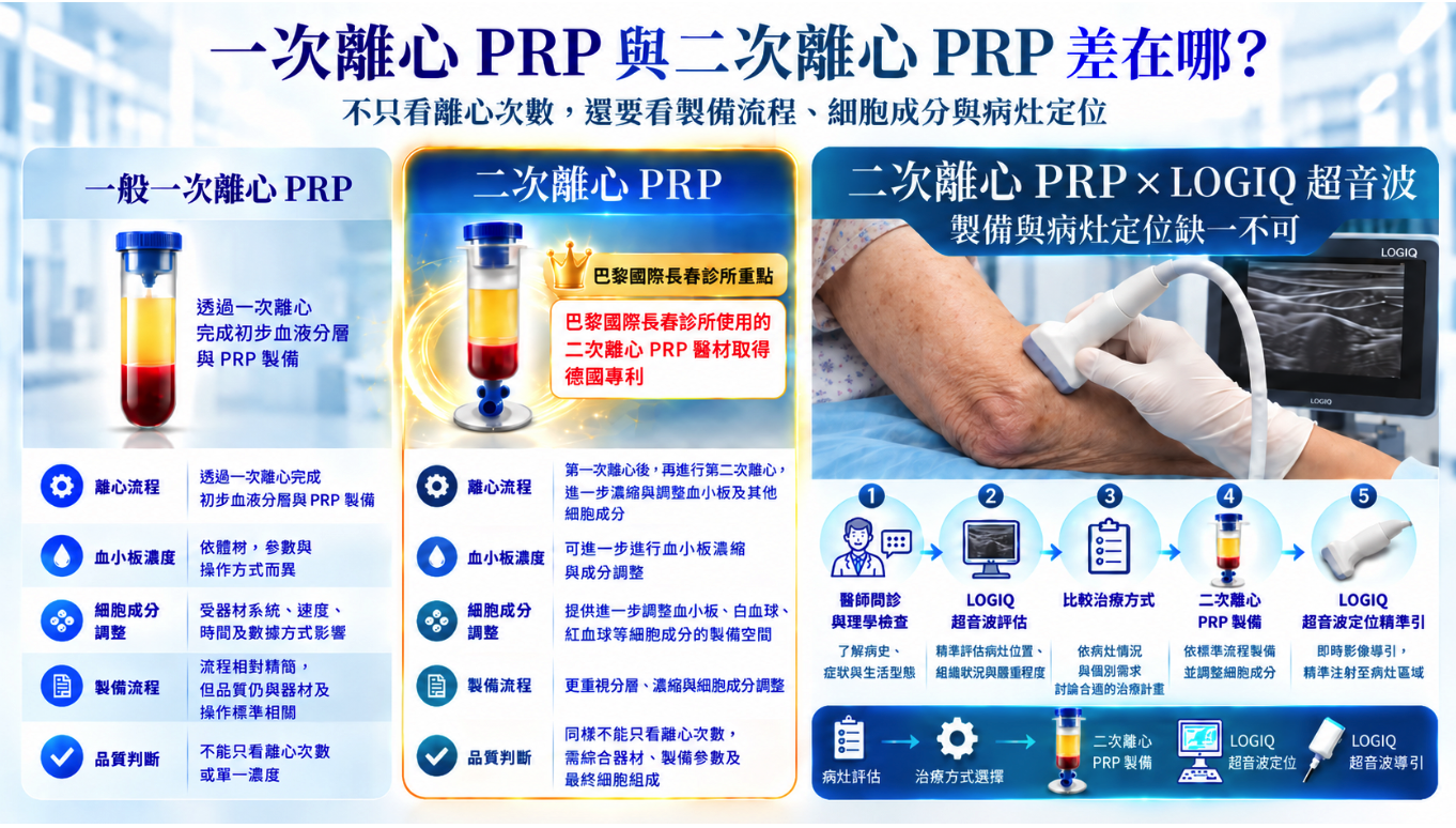 一次離心 PRP 和二次離心 PRP 有什麼差別?巴黎國際長春診所衛教圖解析,一次離心 PRP 完成初步血液分層與製備,二次離心 PRP 則在第一次離心後再次進行濃縮,進一步調整血小板及白血球、紅血球等細胞成分。PRP 品質不能只看離心次數,還與離心速度、時間、醫材系統、取樣與操作流程有關。巴黎國際長春診所所使用的二次離心 PRP 醫材取得德國專利,並搭配 LOGIQ 超音波儀進行網球肘肌腱與周邊軟組織評估、病灶定位及導引,形成病灶評估、治療方式選擇、二次離心 PRP 製備、LOGIQ 超音波定位與導引的治療規劃流程。