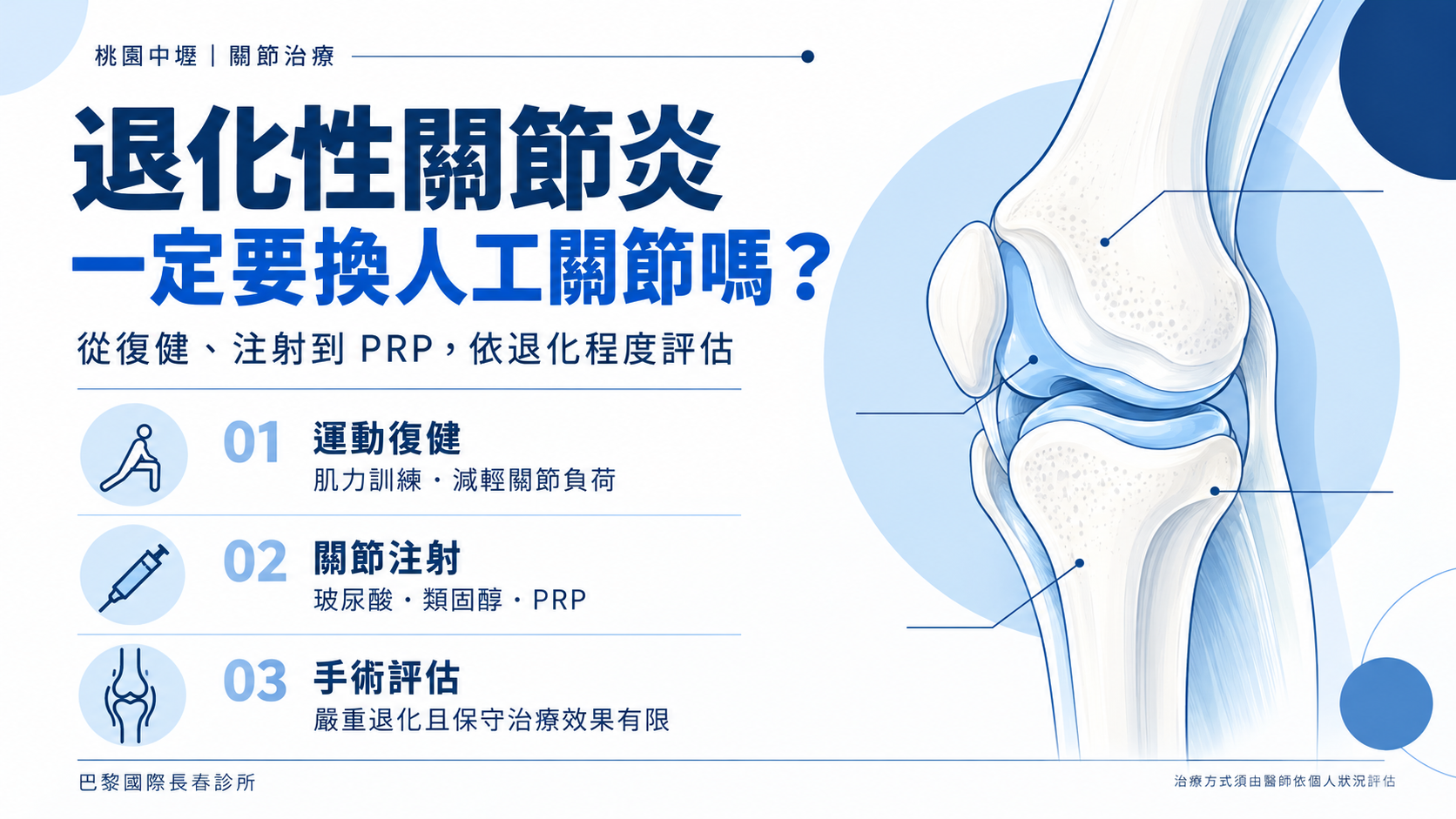 【桃園中壢】退化性關節炎一定要換人工關節嗎?治療從復健、注射到PRP一次看