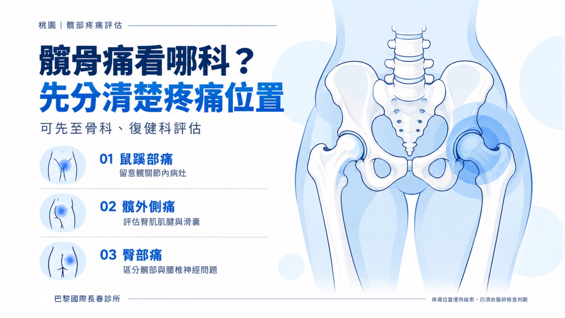 【桃園】髖骨痛看哪科?鼠蹊部、髖外側與臀部痛的原因、檢查及治療一次看