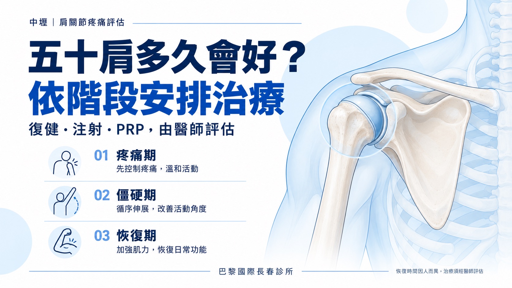 【中壢最新解方】五十肩多久會好?從疼痛期、沾黏期到復健、注射與PRP治療一次看